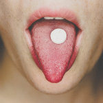 Understanding Cracks on Tongue (Fissured Tongue): Causes, Symptoms, and When to Worry